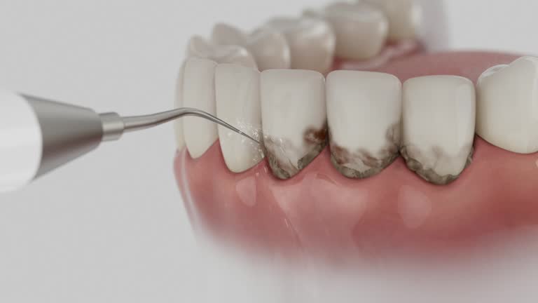 Trusted Dental Implants service in Houston, PA - Dentist Open Now
